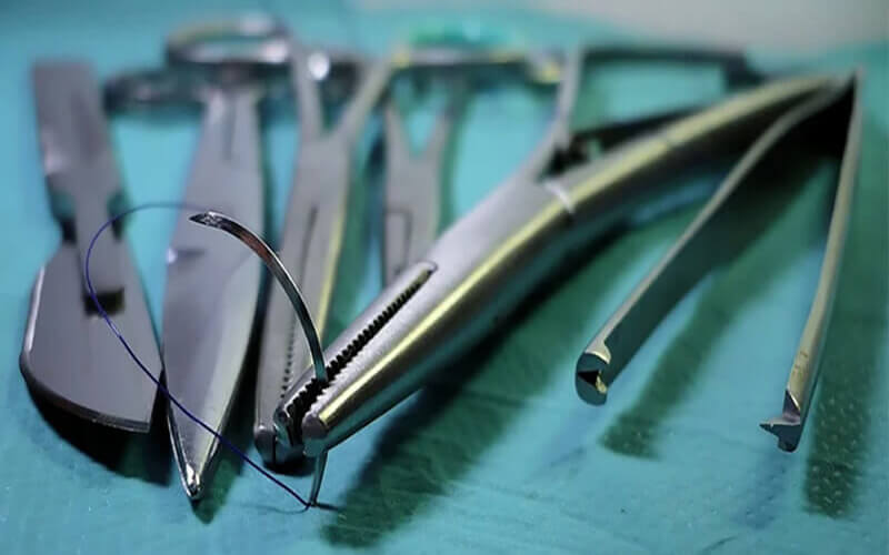 Studio Dentistico Oriolo | Dentista a Lido di Ostia | Chirurgia Dentale