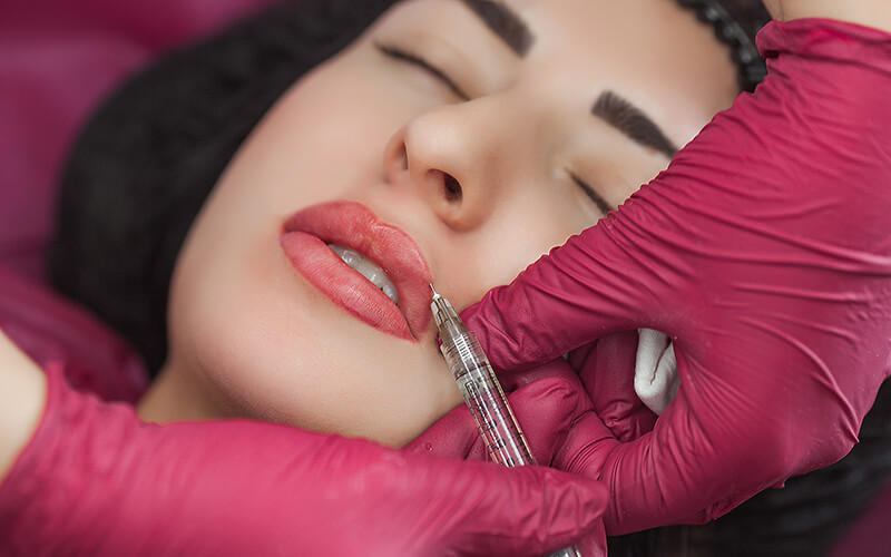 Studio Dentistico Oriolo | Trattamenti Antiaging filler labbra acido ialuronico Lido di Ostia