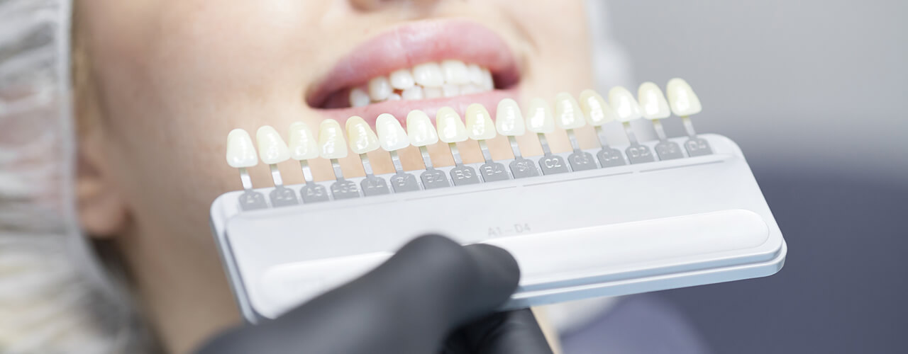 Studio Dentistico Oriolo | Sbiancamento Dentale Poltrona