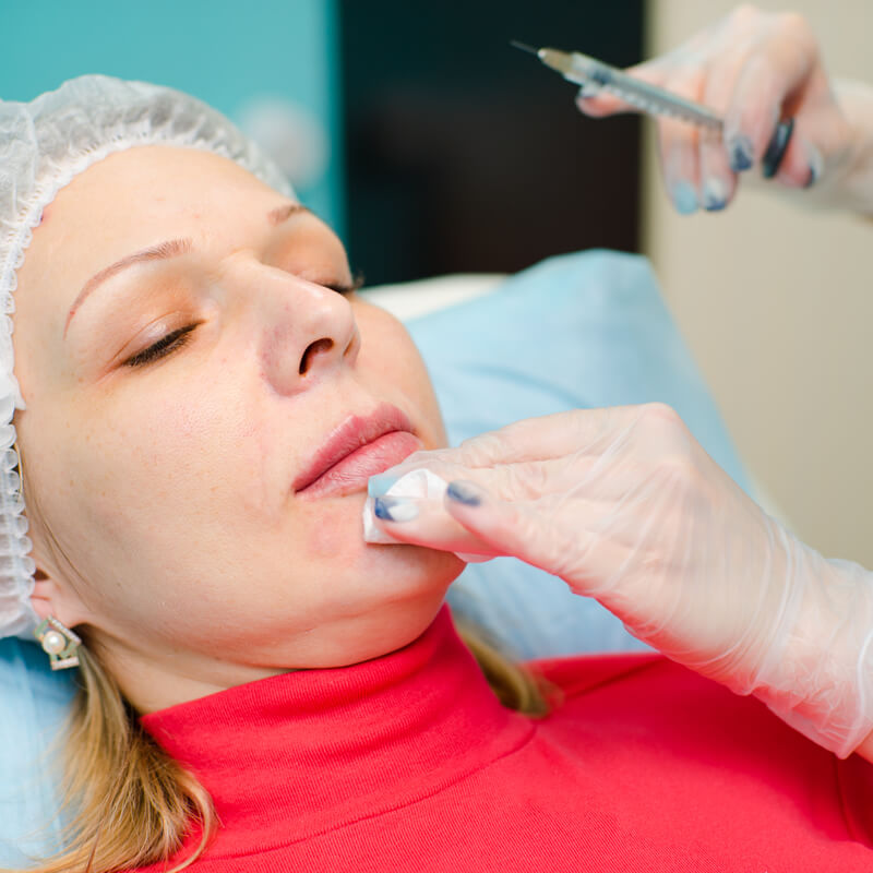 Studio Dentistico Oriolo | Trattamenti Anti Aging Filler Acido Ialuronico Contorno Labbra
