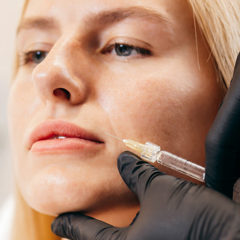 Studio Dentistico Oriolo | Trattamenti Anti Aging Filler Acido Ialuronico Ruga Naso Labiale