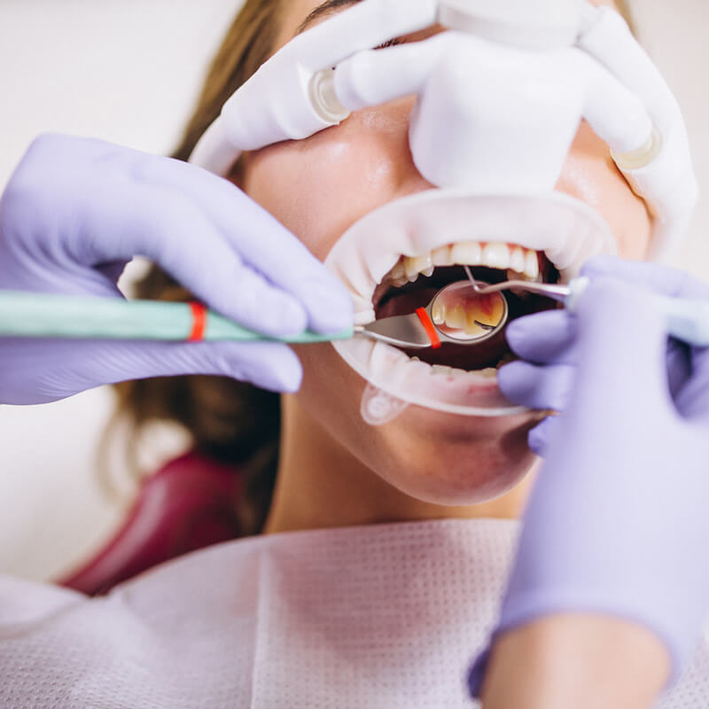 Studio Dentistico Oriolo | Sedazione Cosciente Intervento Protossido Azoto