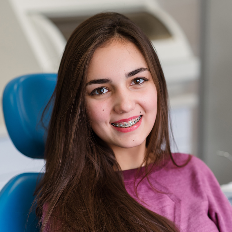 Studio Dentistico Oriolo | Lido Di Ostia | Ortodonzia Terapia Ortodontica Fissa Ragazza
