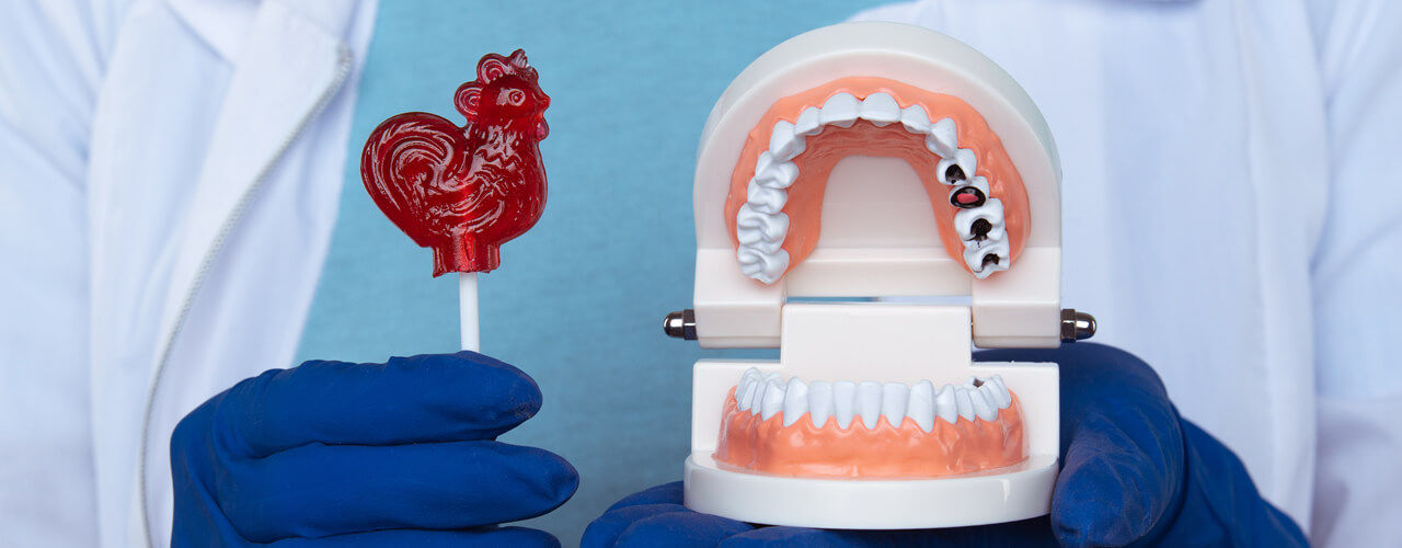 Studio Dentistico Oriolo | Ostia Lido | Carie Dentale