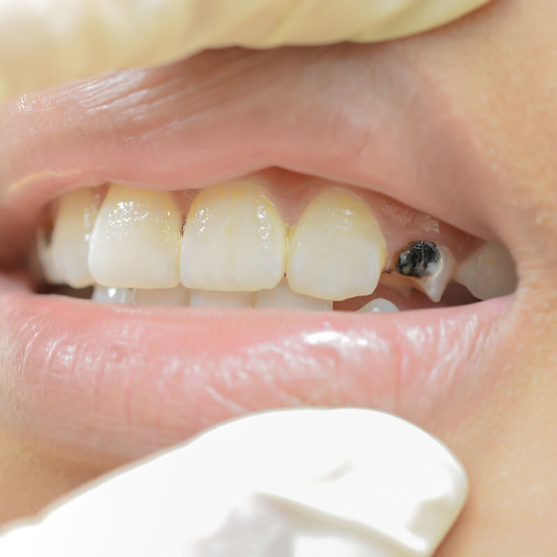 Studio Dentistico Oriolo | Ostia Lido | Salute Orale Nel Bambino