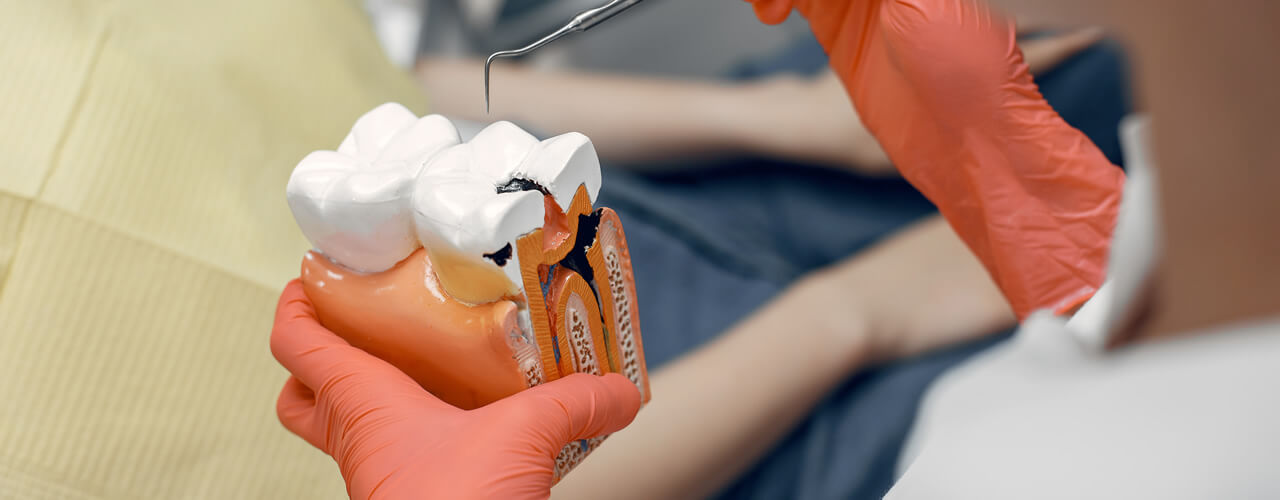 Studio Dentistico Oriolo | Ostia Lido | Mal Di Denti | Pulpite 