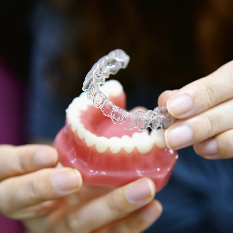 Studio Dentistico Oriolo | Ostia Lido | Ortodonzia Invisibile Invisalign | Mascherine Modello