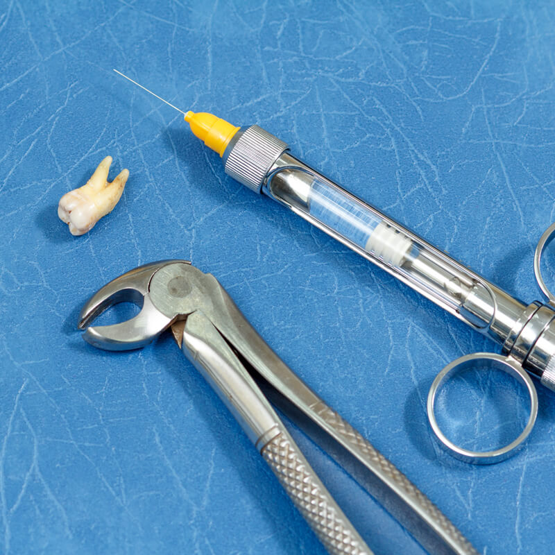 Studio Dentistico Oriolo | Ostia Lido | Denti Del Giudizio | Anestesia