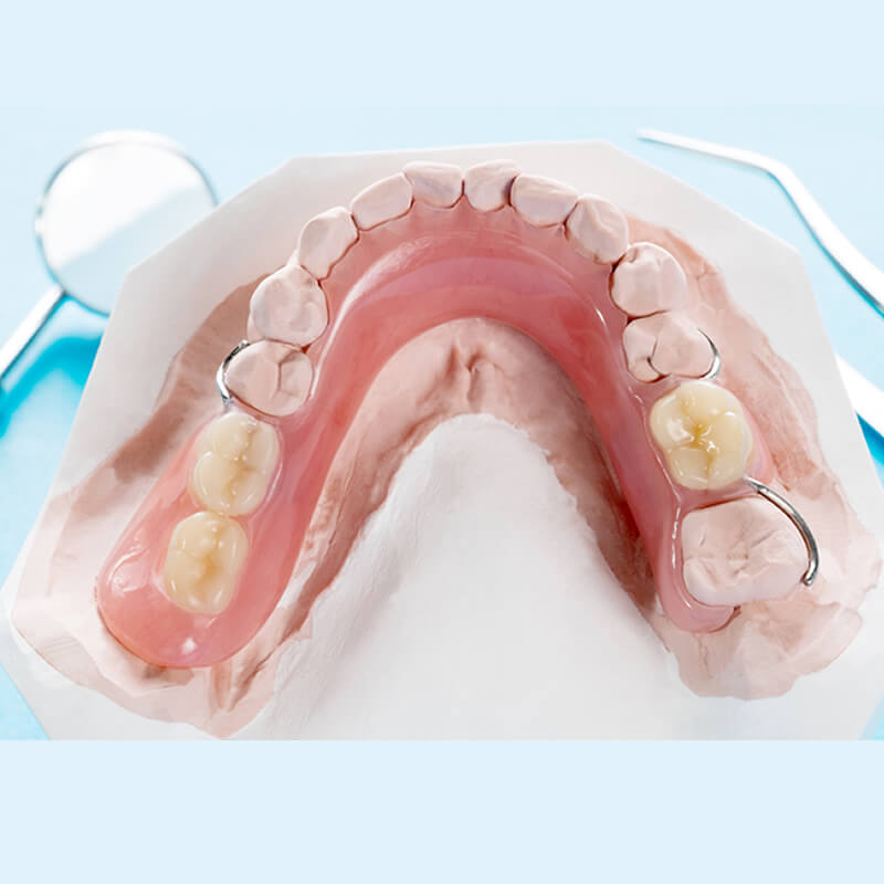 Studio Dentistico Oriolo | Parziale Superiore Ostia Lido | Protesi Mobile | Parziale Inferiore