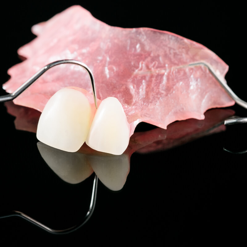 Studio Dentistico Oriolo | Parziale Superiore Ostia Lido | Protesi Mobile | Parziale