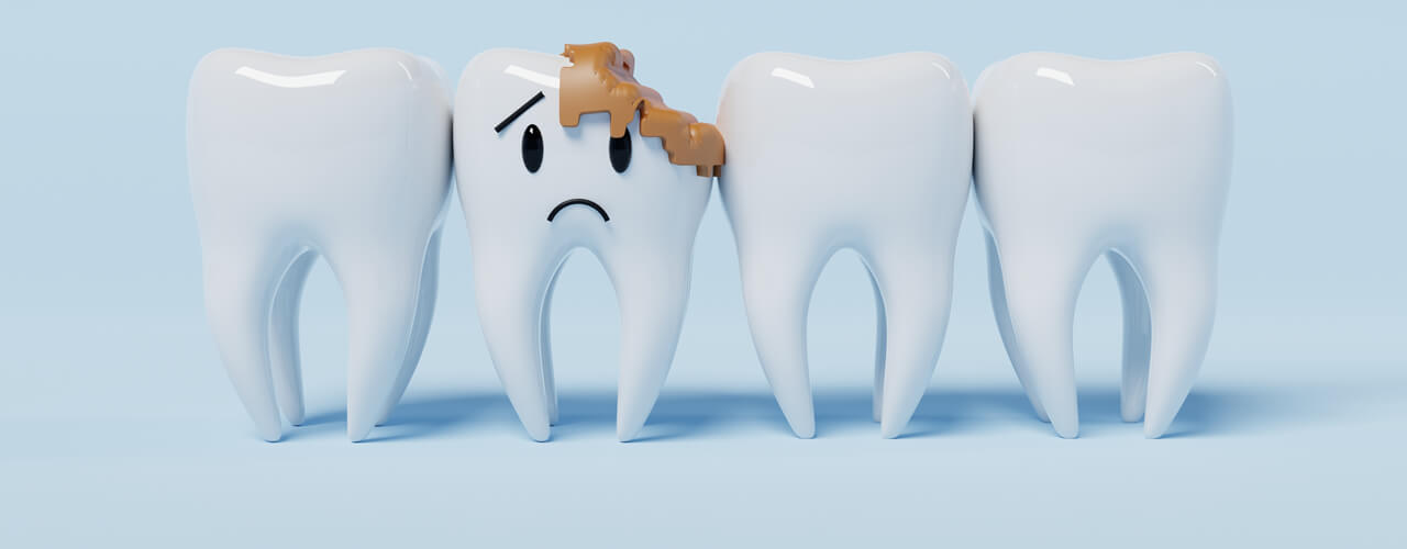 Studio Dentistico Oriolo | Parziale Superiore Ostia Lido | Ascesso Dentale | Carie Dentale