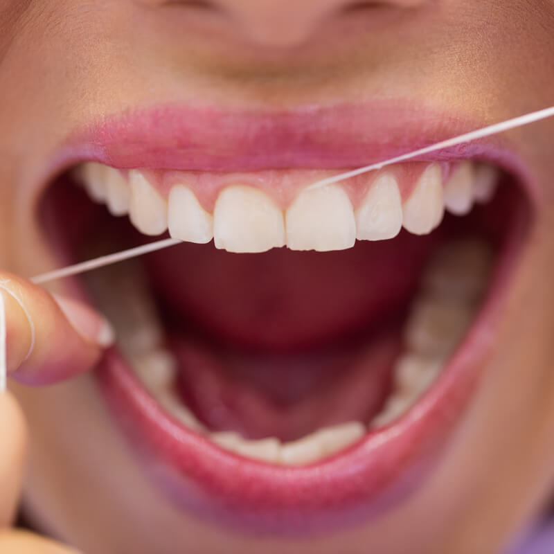 Studio Dentistico Oriolo | Ostia Lido | Medicina Estetica Dal Dentista | Lavare i Denti Con Metodo | Flossing
