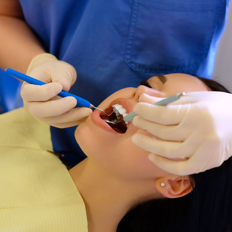 Studio Dentistico Oriolo | Ostia Lido | Visita Dentistica Dopo Le Vacanze | Visita