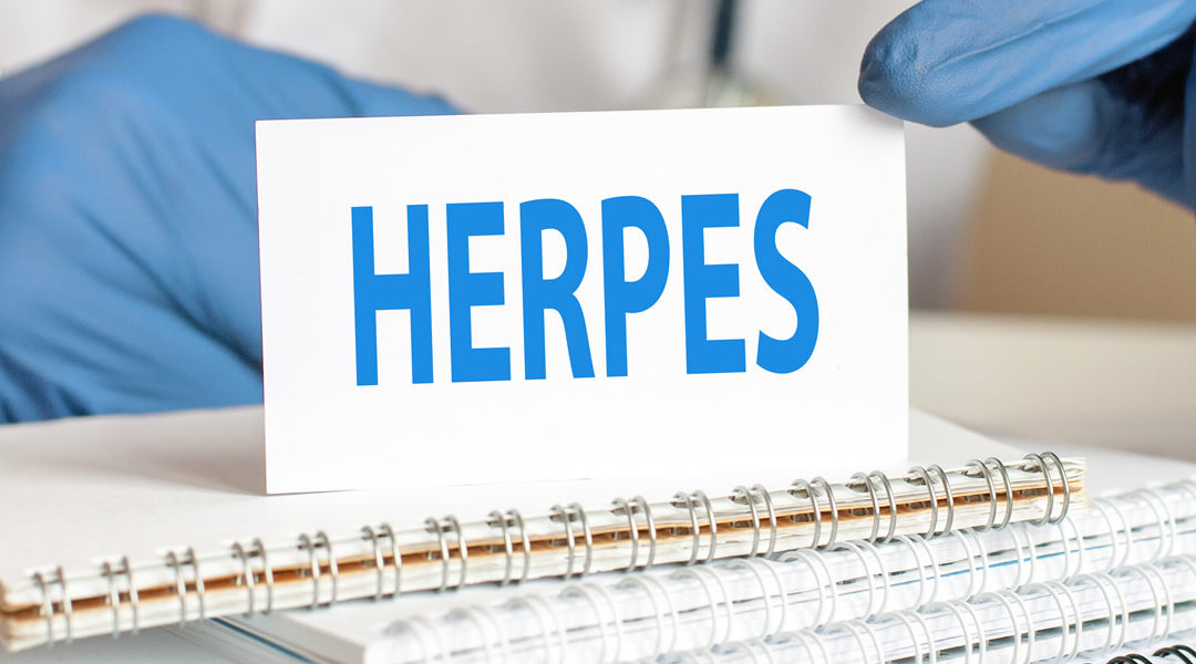 Herpes Labiale: cause, sintomi e cura