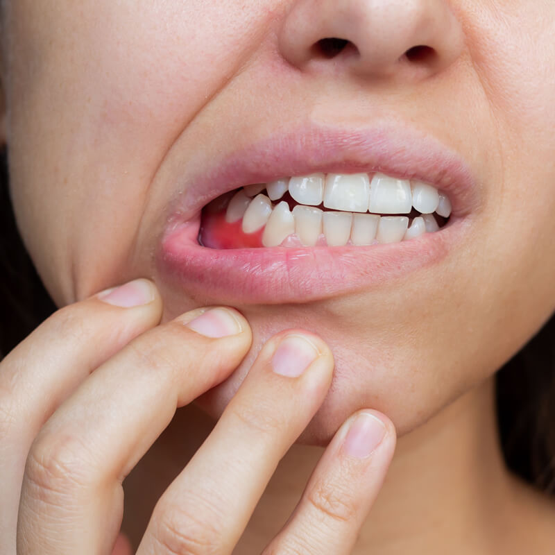 Studio Dentistico Oriolo | Lido di Ostia | Diabete e Parodontite un Legame Reciproco | Gengivite