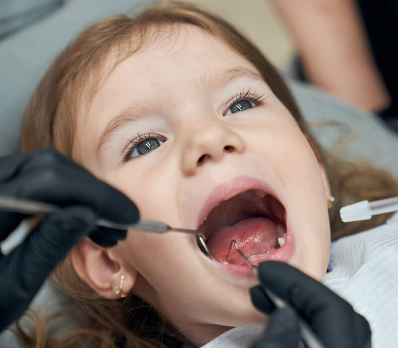 Studio-Dentistico-Oriolo-Ostia-Lido-Pedodonzia