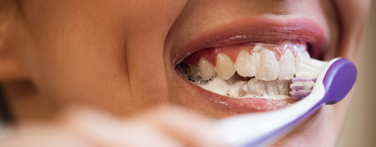Studio Dentistico Oriolo | Lido di Ostia | Domande e Risposte sulle Otturazioni Dentali | Lavare i Denti