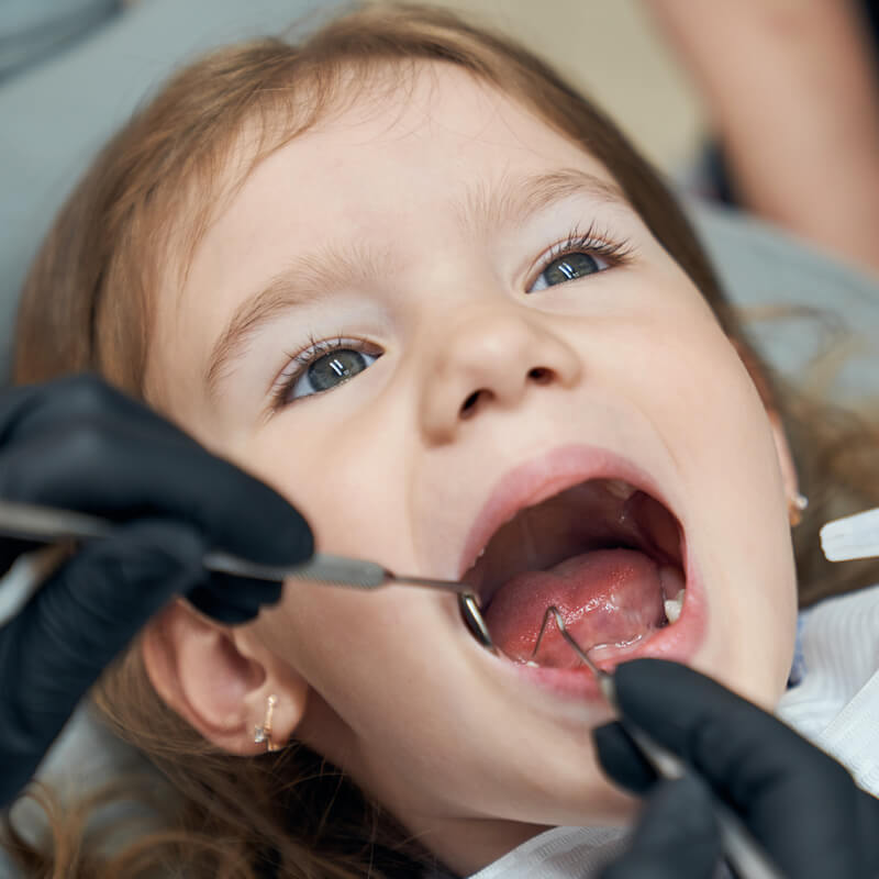 Studio Dentistico Oriolo | Pedodonzia| Lido di Ostia | A che Età Far Fare la Prima Visita Dentistica ai Bambini e Perché | Bambino