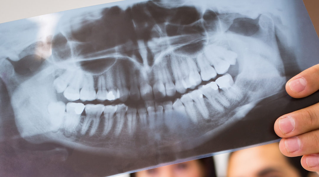 Tutte le domande sulla Radiologia Odontoiatrica