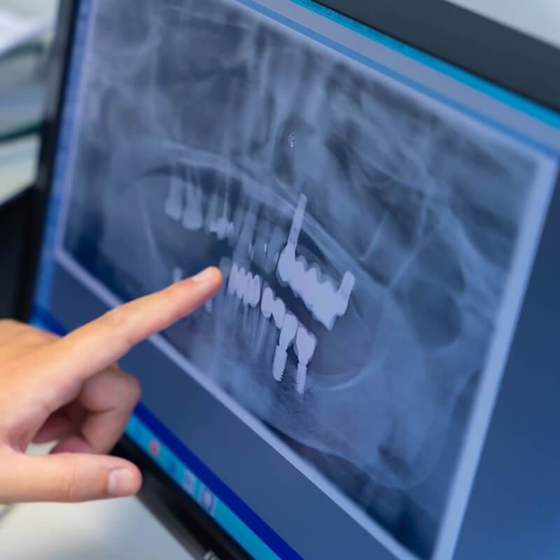 Studio Dentistico Oriolo | Lido di Ostia | Radiologia Odontoiatrica | Panoramica Dentista