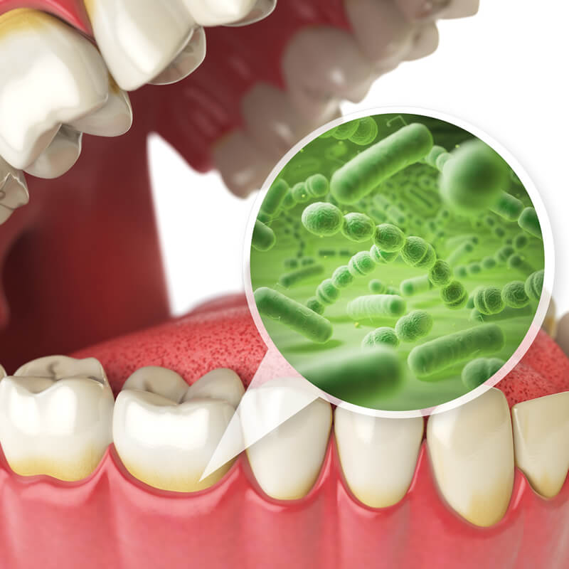 Studio Dentistico Oriolo | Lido di Ostia | Prevenzione Carie e Tartaro | Placca Batterica