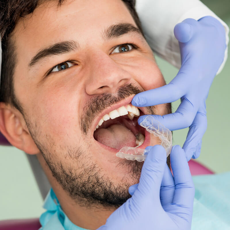 studio-dentistico-oriolo-ostia-lido-occlusione-e-postura-gnatologia Studio Dentistico Oriolo | Lido di Ostia | Occlusione e Postura | Gnatologia